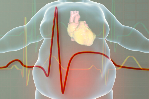 A transparent body showing the heart: Obersity and heart disease