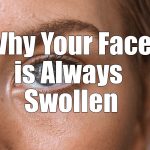 Why Your Face is Always Swollen and How to Address it