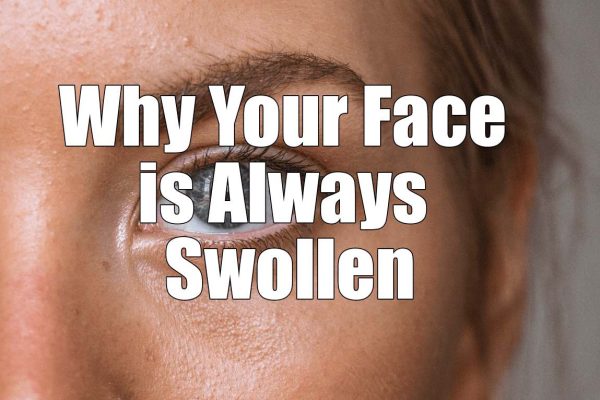 Why Your Face is Always Swollen and How to Address it